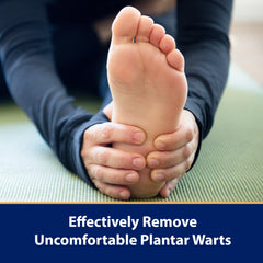 Compound W Wart Remover One Step Medicated Foot Pads- 20 Count - With Salicylic Acid, Maximum Strength, Effective Wart Removal