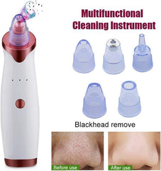 Blackhead Remover Pore Vacuum Extractor Pore Cleaner Electronic Comedone Remover